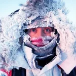 Two Cases of Frostbite Recorded in Rivne Region