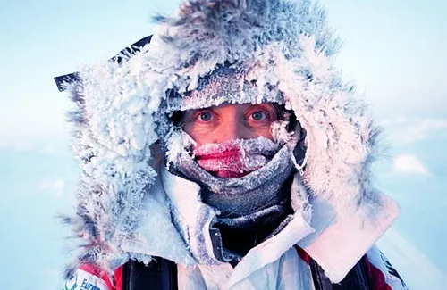 Two Cases of Frostbite Recorded in Rivne Region