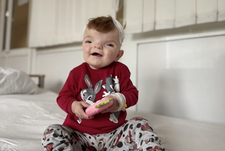 Neurosurgeons in Lviv Successfully Performed Skull Surgery on a One-Year-Old Girl