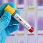 A Case of Listeriosis Detected in Rivne Region for the First Time in 12 Years