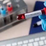 Rivne Blood Center Received New Equipment for Plasmaferesis